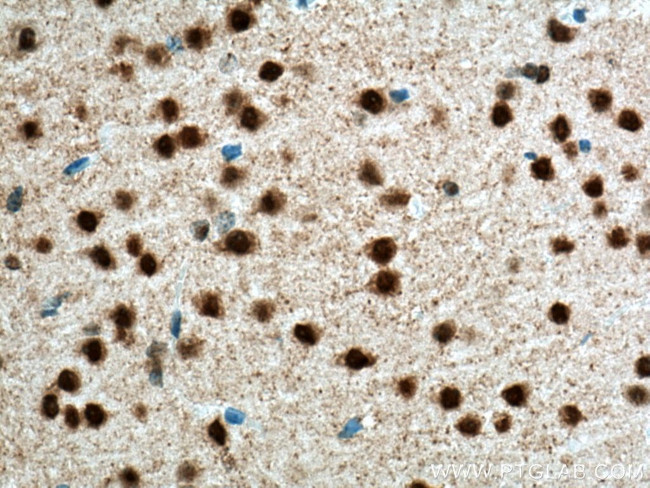 NeuN Antibody in Immunohistochemistry (Paraffin) (IHC (P))