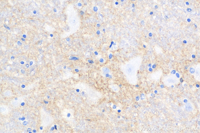 L1CAM Antibody in Immunohistochemistry (Paraffin) (IHC (P))