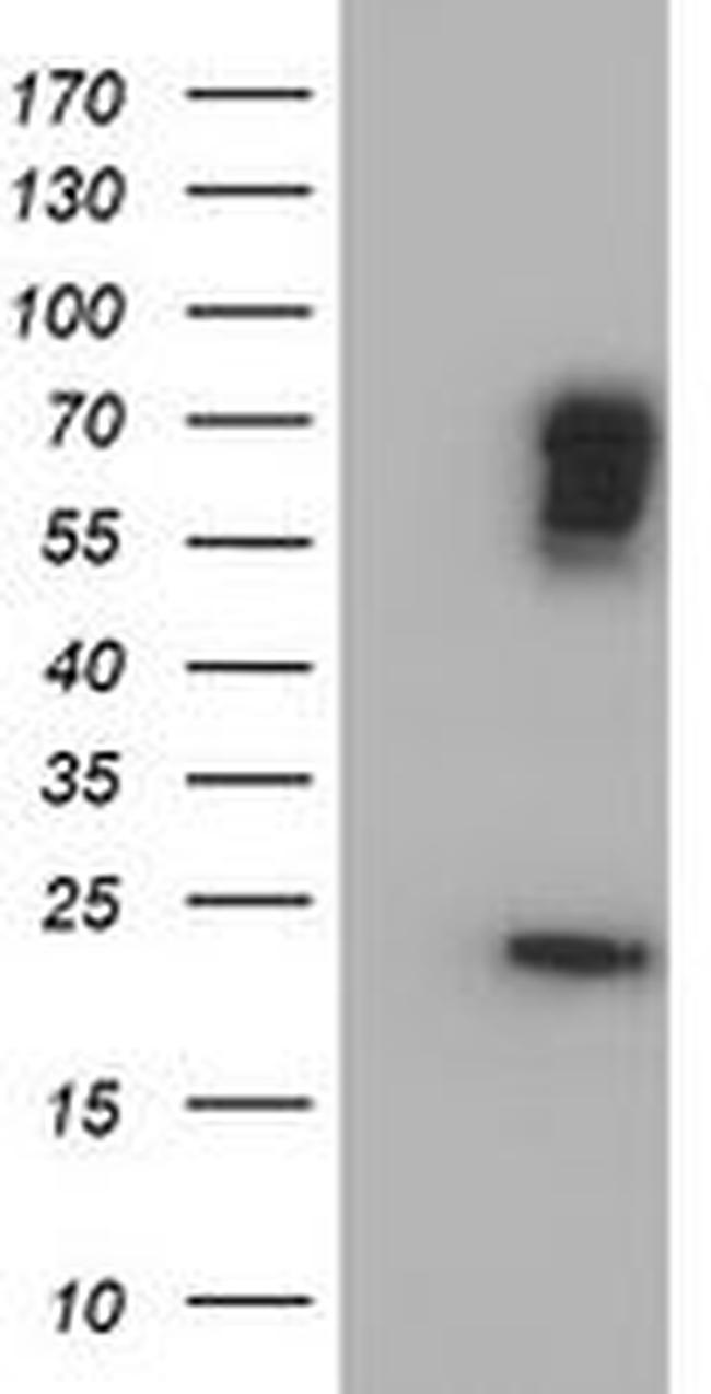 BIRC3 Antibody in Western Blot (WB)
