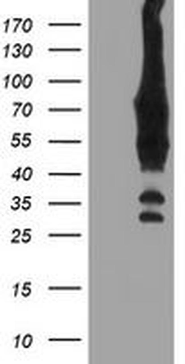 BIRC3 Antibody in Western Blot (WB)