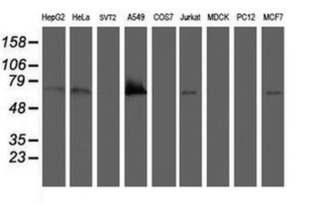 BIRC3 Antibody in Western Blot (WB)