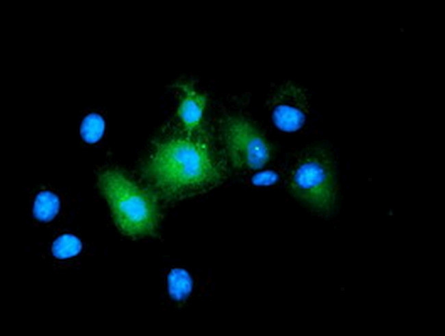 BIRC5/Survivin Antibody in Immunocytochemistry (ICC/IF)