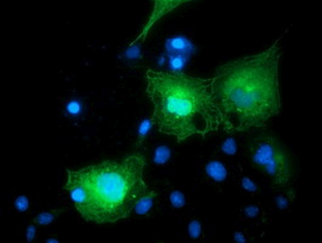 BIRC5/Survivin Antibody in Immunocytochemistry (ICC/IF)