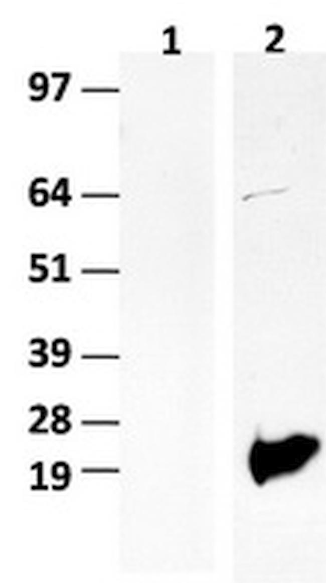 BIRC5/Survivin Antibody in Western Blot (WB)
