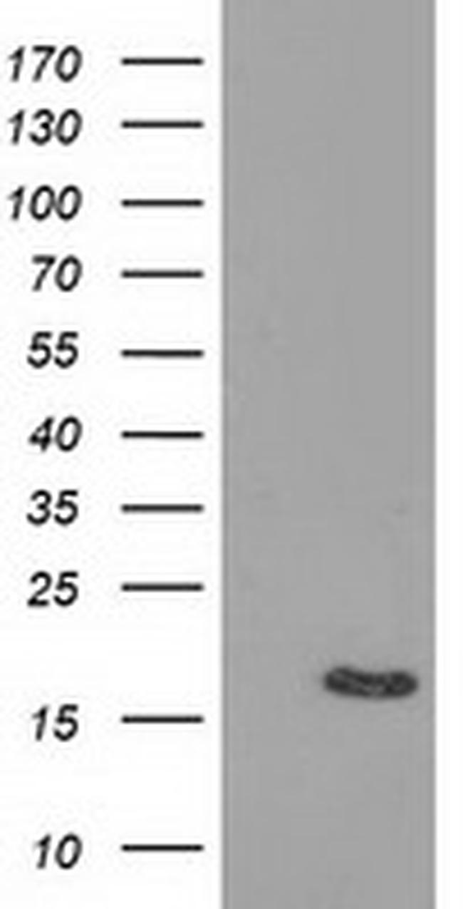 BIRC5/Survivin Antibody in Western Blot (WB)