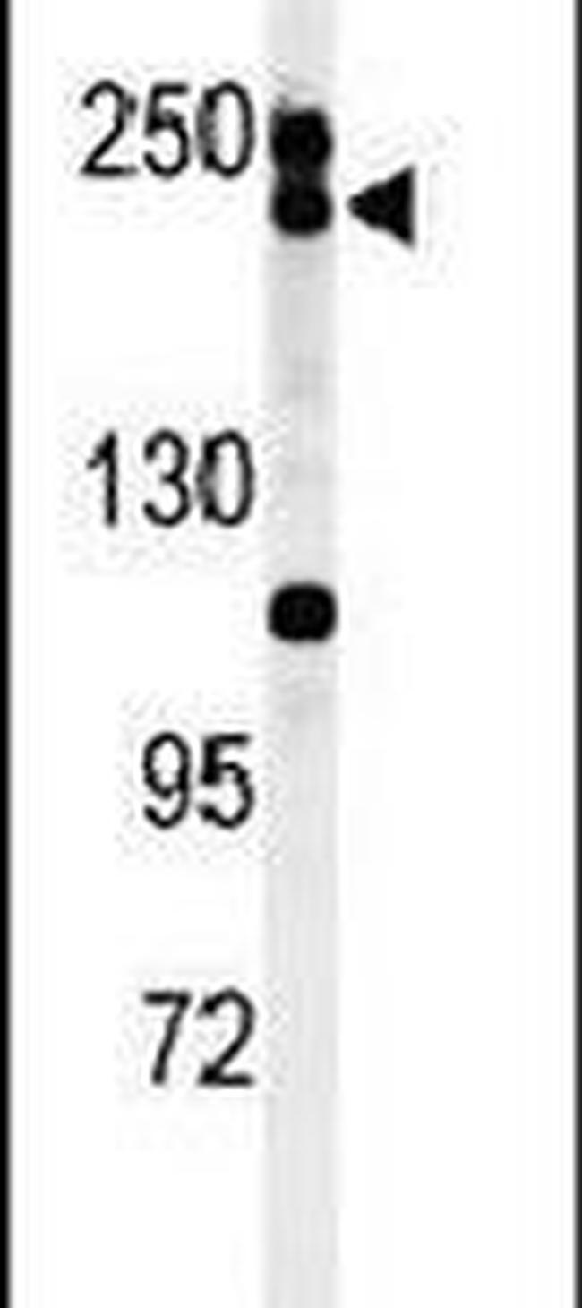 Blooms Syndrome Antibody in Western Blot (WB)