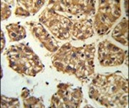 BLNK Antibody in Immunohistochemistry (IHC)