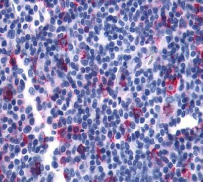 LTB4R2 Antibody in Immunohistochemistry (Paraffin) (IHC (P))