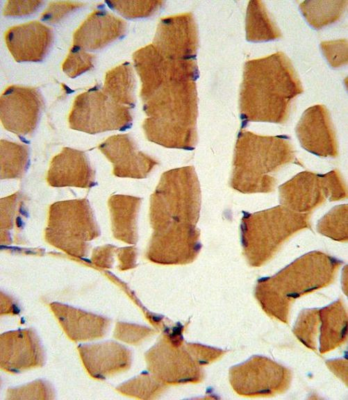 BMI-1 Antibody in Immunohistochemistry (IHC)