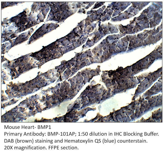 BMP1 Antibody in Immunohistochemistry (IHC)