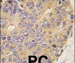 BMP-15 Antibody in Immunohistochemistry (IHC)