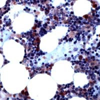 BMP-4 Antibody in Immunohistochemistry (IHC)