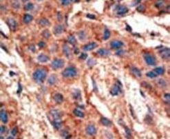BMPR1A Antibody in Immunohistochemistry (IHC)