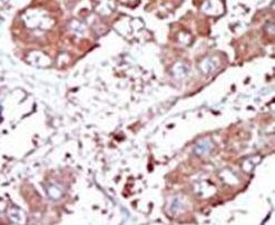 BMPR1A Antibody in Immunohistochemistry (IHC)
