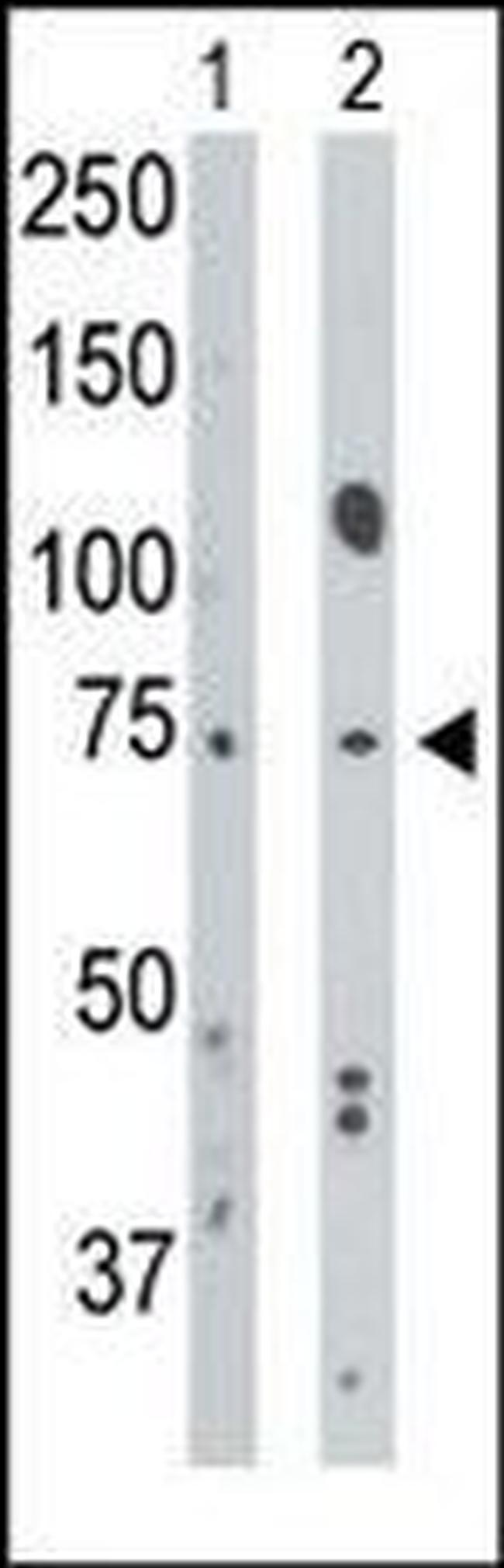 BMPR1A Antibody in Western Blot (WB)
