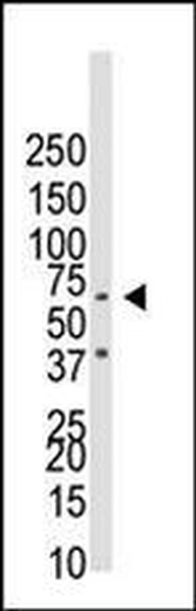 CDw293 Antibody in Western Blot (WB)