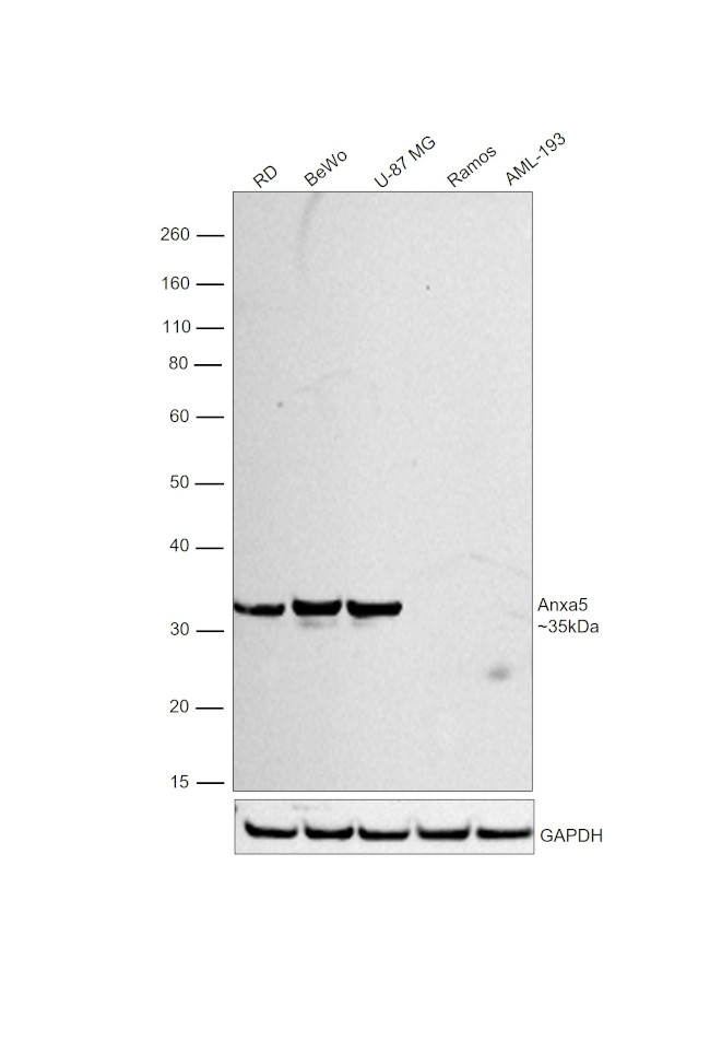 Annexin V Antibody in Western Blot (WB)