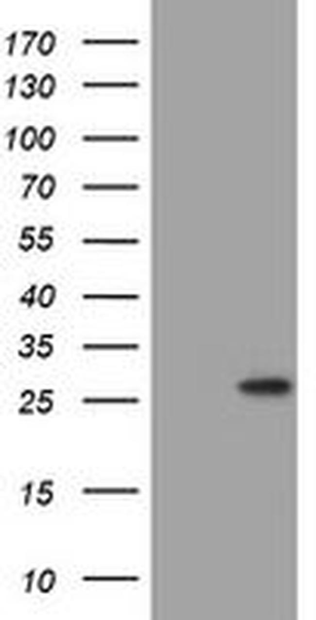 BNIP1 Antibody in Western Blot (WB)