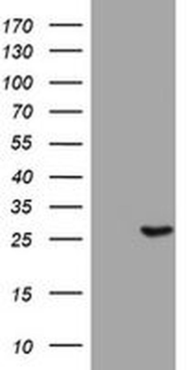 BNIP1 Antibody in Western Blot (WB)