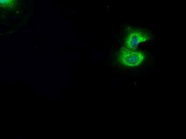 BRAF Antibody in Immunocytochemistry (ICC/IF)