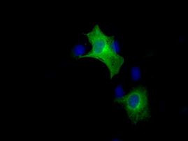 BRAF Antibody in Immunocytochemistry (ICC/IF)