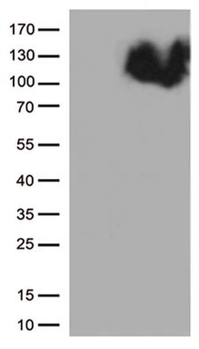 BRAF Antibody in Western Blot (WB)