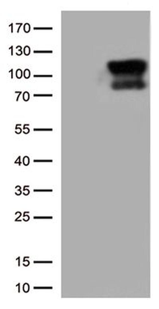 BRAF Antibody in Western Blot (WB)