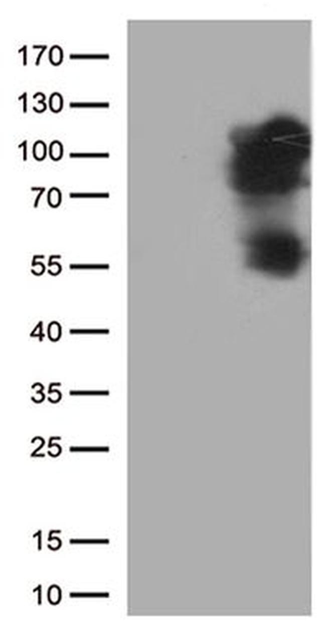 BRAF Antibody in Western Blot (WB)
