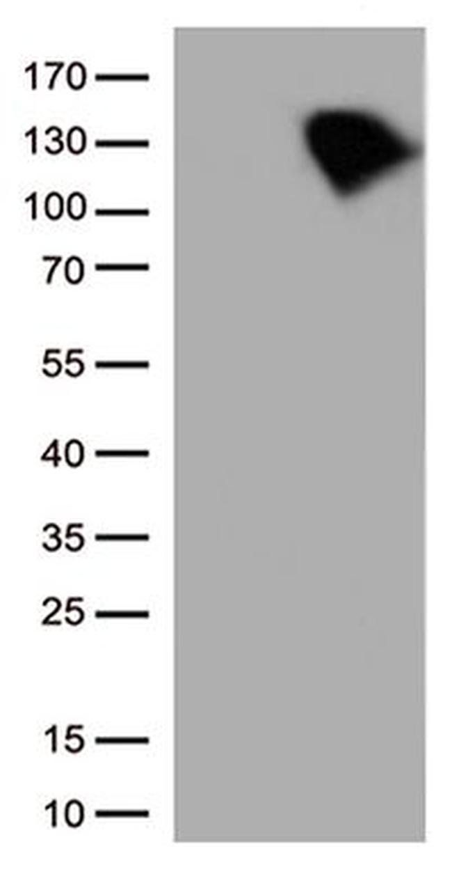BRAF Antibody in Western Blot (WB)