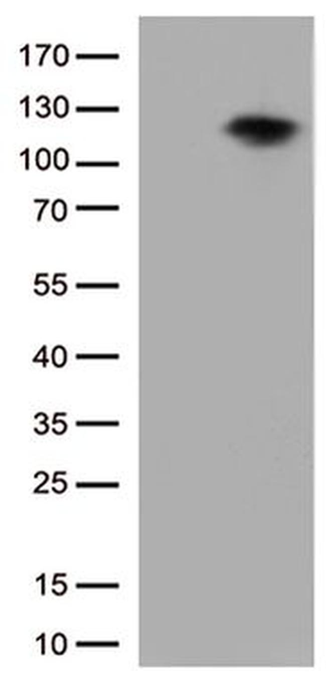 BRAF Antibody in Western Blot (WB)