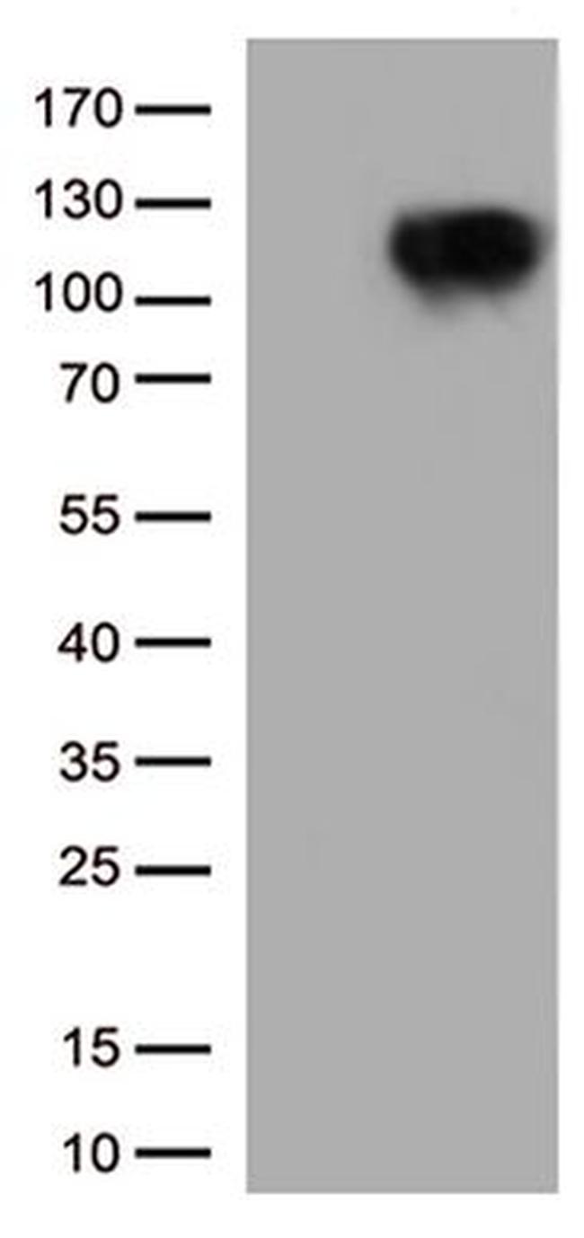 BRAF Antibody in Western Blot (WB)