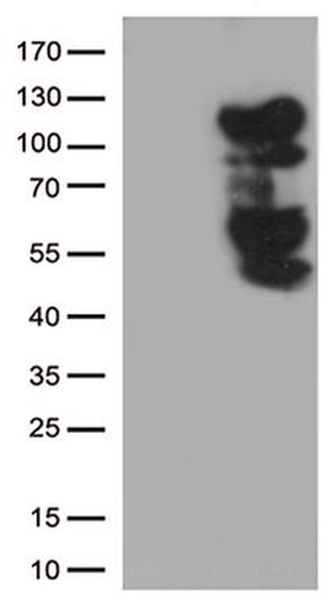 BRAF Antibody in Western Blot (WB)