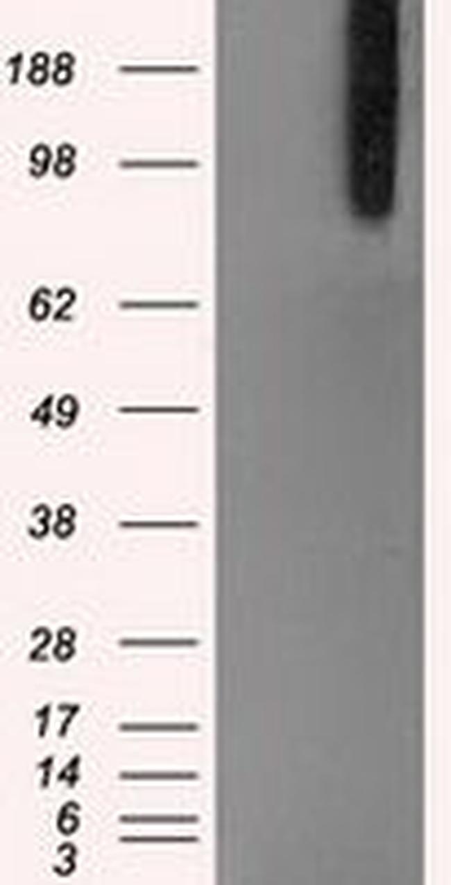 BRAF Antibody in Western Blot (WB)