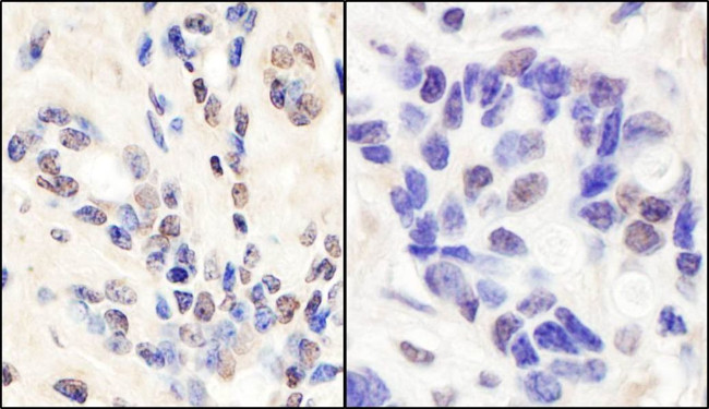 BRCA1 Antibody in Immunohistochemistry (IHC)