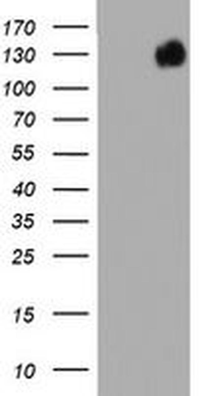 BRCA1 Antibody in Western Blot (WB)