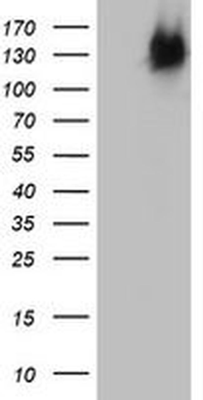 BRCA1 Antibody in Western Blot (WB)