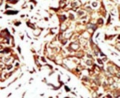 BRD3 Antibody in Immunohistochemistry (IHC)