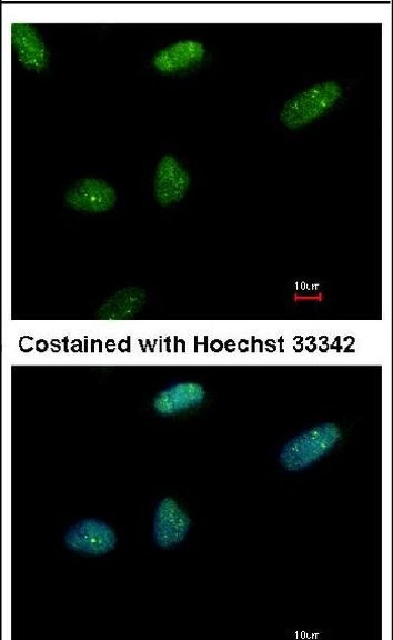 BRMS1 Antibody in Immunocytochemistry (ICC/IF)