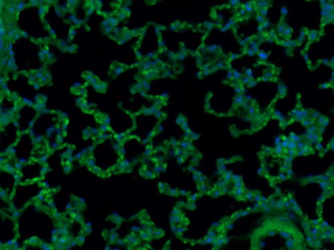 CD8 Antibody in Immunohistochemistry (Paraffin) (IHC (P))