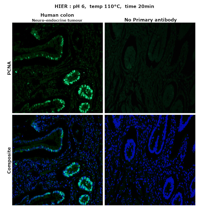 PCNA Antibody in Immunohistochemistry (Paraffin) (IHC (P))