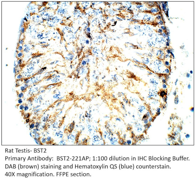 BST2 Antibody in Immunohistochemistry (IHC)