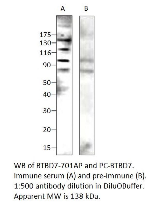 BTBD7 Antibody in Western Blot (WB)