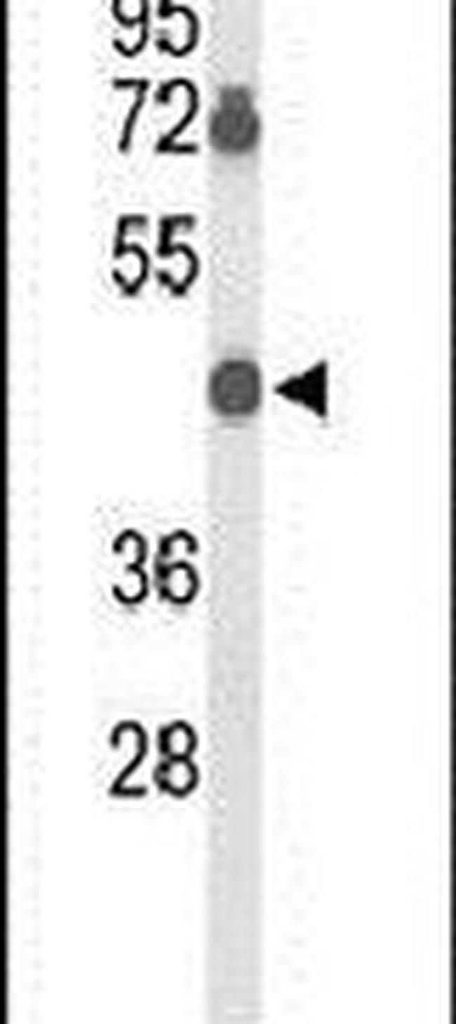 BTBD10 Antibody in Western Blot (WB)