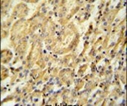 BTBD9 Antibody in Immunohistochemistry (IHC)