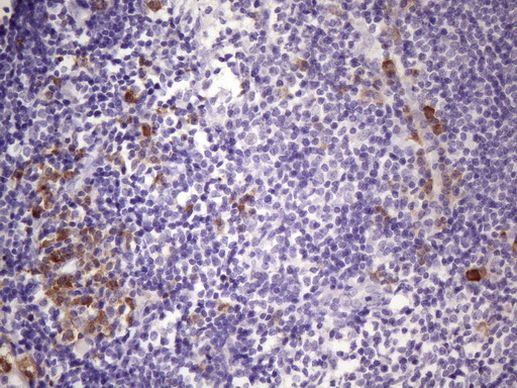 BTG2 Antibody in Immunohistochemistry (Paraffin) (IHC (P))