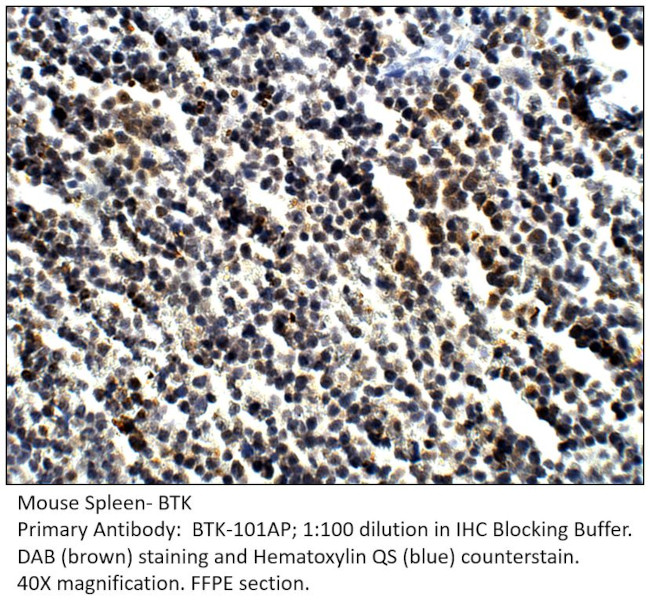 BTK Antibody in Immunohistochemistry (IHC)