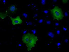 BTK Antibody in Immunocytochemistry (ICC/IF)