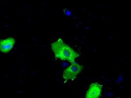 BTK Antibody in Immunocytochemistry (ICC/IF)