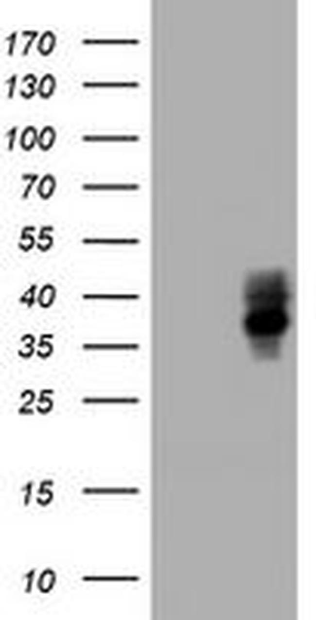 BTLA Antibody in Western Blot (WB)