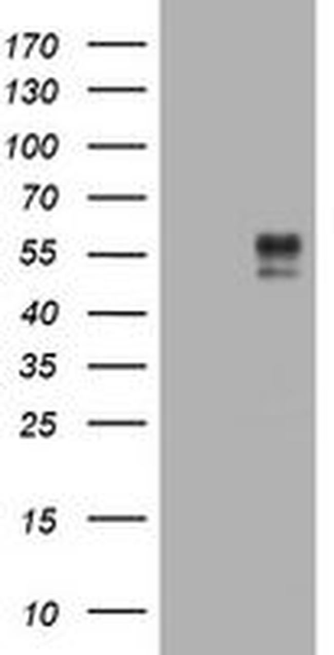 BTLA Antibody in Western Blot (WB)
